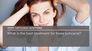 What is the best treatment for hives urticaria [upl. by Regan]