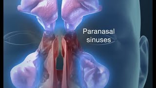 Endoscopic Sinus Surgery for Pain Drainage Infections and Impaired breathing [upl. by Hilario]