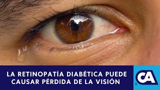 ¿Qué es la Retinopatía Diabética [upl. by Chapen]