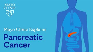 Mayo Clinic Explains Pancreatic Cancer [upl. by Rivy]