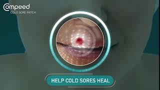 How Compeed Cold Sore patches help cold sores heal [upl. by Anaerol]