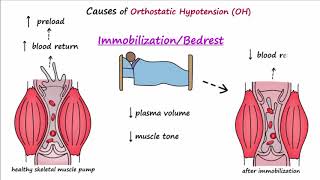 Orthostatic Hypotension Described Concisely [upl. by Akem779]