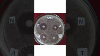 disc diffusion method viral shortvideo sciencefacts [upl. by Littell]