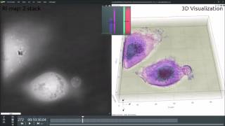 Living Tcell killing a living cancer cell [upl. by Fondea]