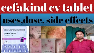 cefakind cv 500 mg tablet uses in hindicefuroxime axetil tablets ip 500mgusesdoseside effects [upl. by Myranda]