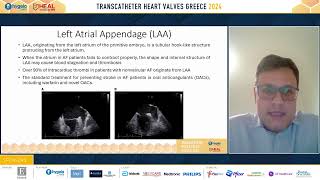 74 Devices for transcatheter closure of ASDPFO and LAA Similarities and differences [upl. by Acinorav]