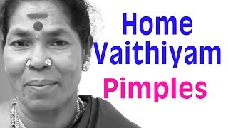 home remedy for pimples  grandmother medicine  village treatment for pimplesTamil [upl. by Sawyor]