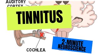 2Minute Neuroscience Tinnitus [upl. by Yziar]