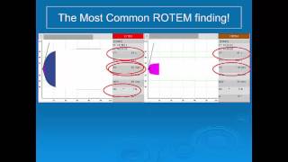 Aussie Drongos introduction to ROTEM [upl. by Martina997]