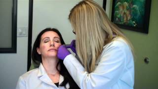 Injection Video Cheeks Undereyes Botox with Before amp After Photos [upl. by Brabazon]