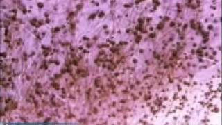 Penicillium Mold Growth [upl. by Aes]