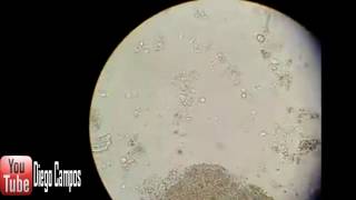 Trichomonas hominis  Coproanalisis [upl. by Aelgna645]