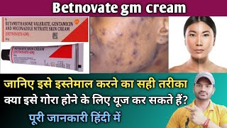 Betnovate gm cream use dose benefits and side effects full review in hindi [upl. by Ainahtan]