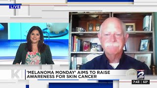 Melanoma Monday aims to raise awareness [upl. by Nico]