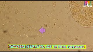 Entamoeba histolytica cyst in stool microscopy [upl. by Zitella599]