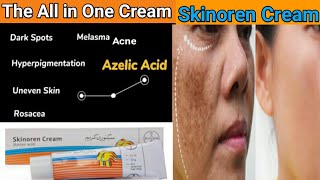 Skinoren Cream Review  Azelic acid Cream  Skinoren Cream How to Use  Benefits  Price [upl. by Nirehtak]