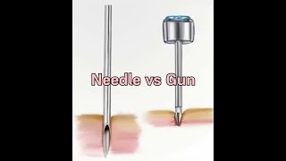 Needle vs Gun Piercing Which Is Safer for Your Ears  Erica Jewels  Piercing Jewelry [upl. by Thorny]