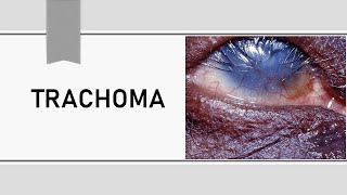 Trachoma Lecture [upl. by Toth]