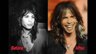 Steven Tyler Plastic Surgery Before and After Photos [upl. by Benedix]