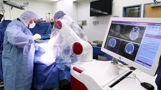 New innovation in pediatric epilepsy treatment the first robotic stereotactic EEG on Long Island [upl. by Reba]