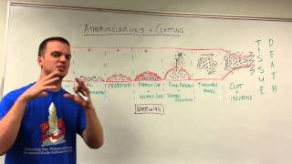 Introduction to Atherosclerosis and Clotting [upl. by Stoffel]