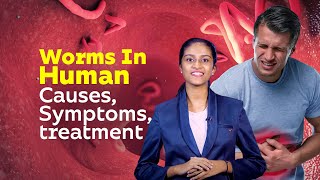 Worms In Human  Causes Symptoms treatment  Healthy Life Style  Worm Diseases [upl. by Palua]