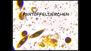 Pantoffeltierchen [upl. by Eelame815]