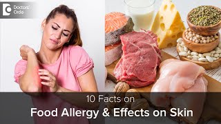 Food Allergy amp how it affects SKIN  Causes Symptoms amp TreatmentDrRajdeep Mysore Doctors Circle [upl. by Lindsy]