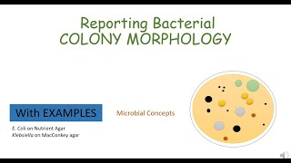 Reporting COLONY MORPHOLOGY of E coli and Klebsiella English  Microbiology practical  Basics [upl. by Selestina]