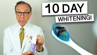 Hismile Purple Toothpaste for 10 Days  Dentist Review teethwhitening [upl. by Lenwood369]