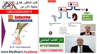 Hyperparathyroidism cme internalmedicine usmle medical محاضراتباطنة [upl. by Piero]