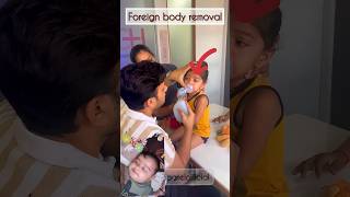 Foreign baby removal😂🤣 baby doctor family drimranpatel shorts shortsfeed short ytshorts [upl. by Giraud]