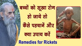 सूखा रोग के कारणलक्षण ओर इलाज  Rickets Causes Symptoms  Swasthya Vichar [upl. by Esenahs]