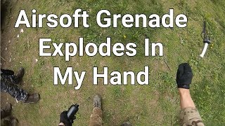 Airsoft Grenade Explodes In My Hand [upl. by Wester]