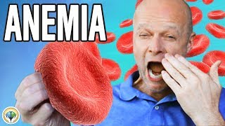 Anemia Explained Simply [upl. by Arlyne193]