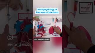 Pathophysiology of Pulmonary Embolisms paramedic cardiology ems [upl. by Rebmeced]