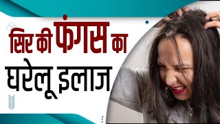 Scalp Fungus  Treatment amp Home Remedies  Dr Mukesh Aggarwal [upl. by Emyle]