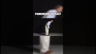 Parkinsonian Gait [upl. by Tray761]