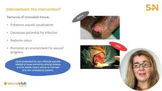 T of TIME  Tissue Module 9 – RevalidationCPD Course  Wound Club Online [upl. by Evaleen]