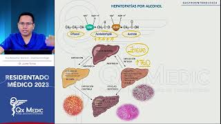 Gastroenterología  13 Hepatopatias por Alcohol [upl. by Eskil]