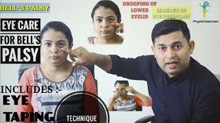 EYE CARE amp EYE TAPING TECHNIQUE FOR BELLS PALSY [upl. by Neelsaj]