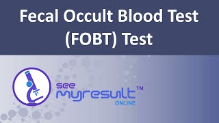 Fecal Occult Blood Test FOBT Test [upl. by Vallery]