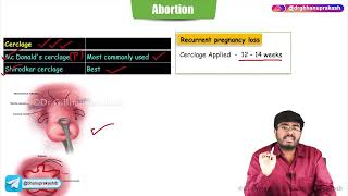 Abortion  Part  2   Obstetrics and Gynaecology Lecture [upl. by Llewsor526]