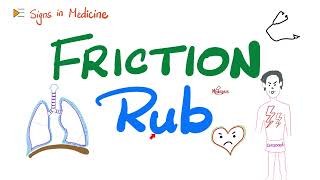 Friction Rub  Pericarditis Pleurisy Pleuritis  Signs in Medicine [upl. by Milstone]