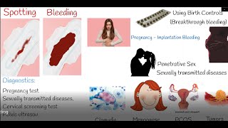 Spotting  Vaginal Bleeding Between periods [upl. by Jermain]