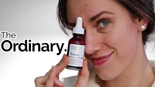 the ordinary peeling solution ONE YEAR results and review [upl. by Francisca]