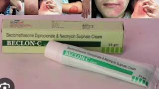 BECLON C Cream Beclomethasone Dipropionate amp Neomycin Sulphate Cream [upl. by Caddric693]