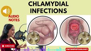 Chlamydia Infections Causes Symptoms and Treatment Options Audio Notes [upl. by Anillek885]