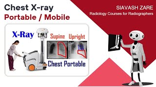 Chest Xray Portable upright semiupright supine Positioning and Technique [upl. by Nodnalb428]