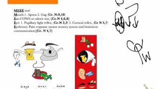 USMLE shortcuts Brainstem death tests2 details [upl. by Leahplar]